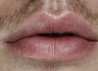 Lippen