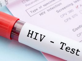 HIV-Selbsttest