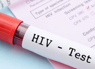 HIV-Selbsttest