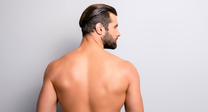 Rückenhaare entfernen