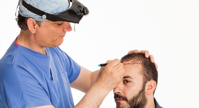 haartransplantation-tuerkei Haartransplantation Türkei