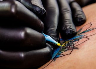 Tatoos entfernen